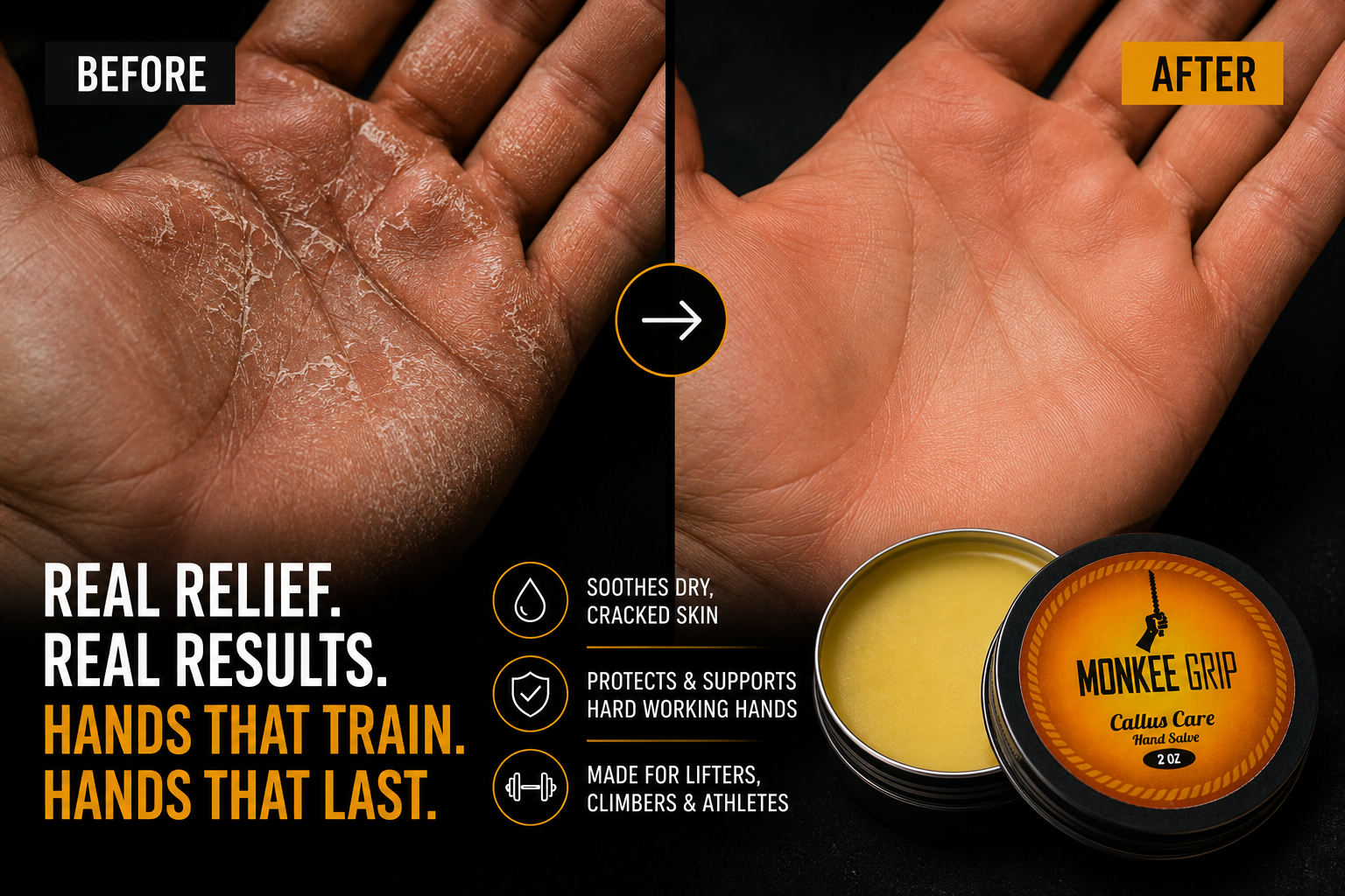 Callus Care